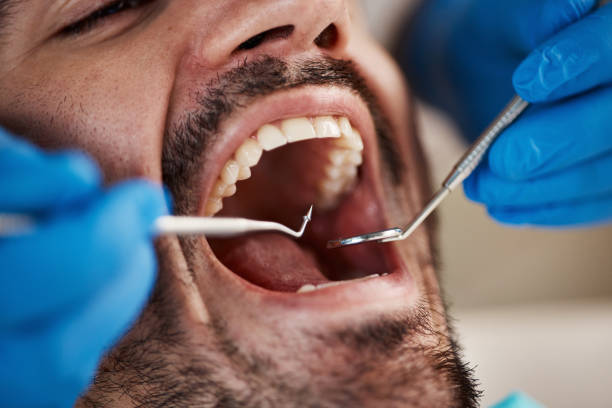 Best Urgent Care for Lost Fillings or Crowns in Athens, OH
