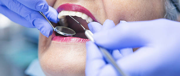 Best Emergency Gum Treatment in Athens, OH
